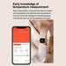 ECG Health Smartwatch – AMOLED Display & AI Voice Calling SF