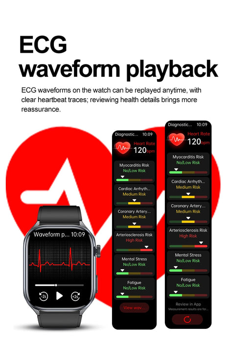 Health Smartwatch – ECG & AI Five-Organ Monitoring SF